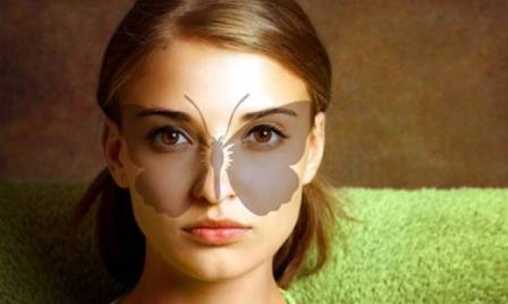 Системная красная волчанка