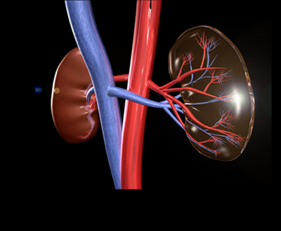 Повреждение почки остановили ультразвуком