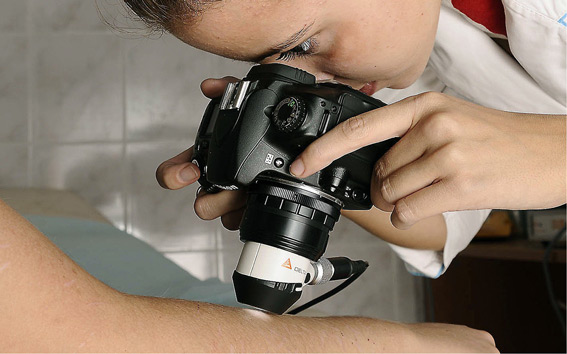 Вирусные бородавки