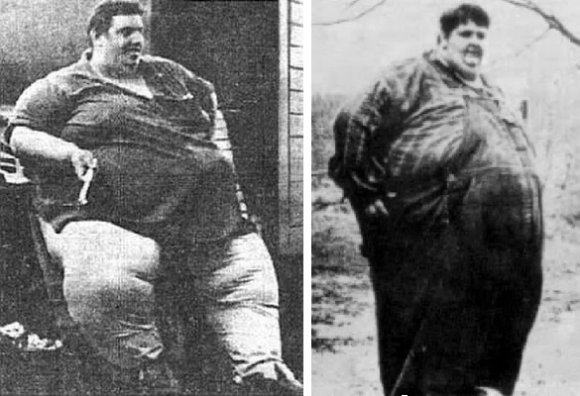 10 невероятных случаев в медицине