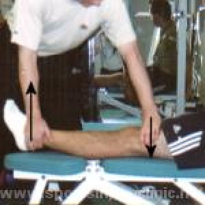 Разрыв задней крестообразной связки