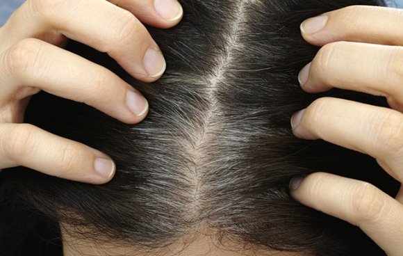 Проблемы с волосами - узнайте, о чем они говорят