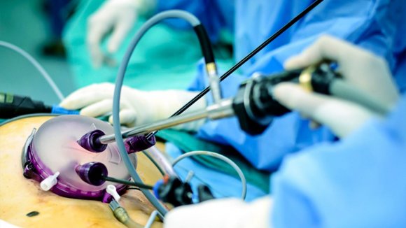 Колет в правом боку? 3 стадии желчнокаменной болезни