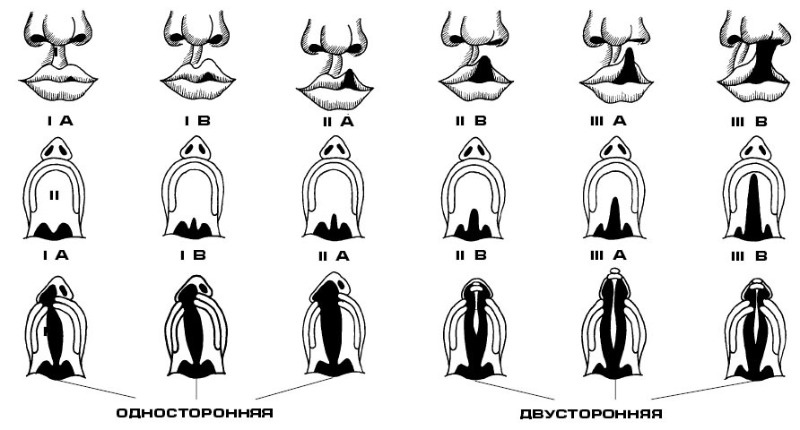 Расщелина неба