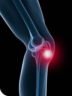 Боль в колене