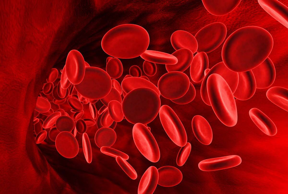 Железодефицитная анемия