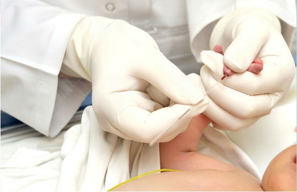 Неонатальная желтуха