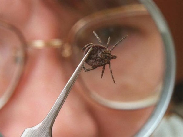 Риккетсиоз