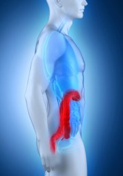 Удаление полипов прямой кишки