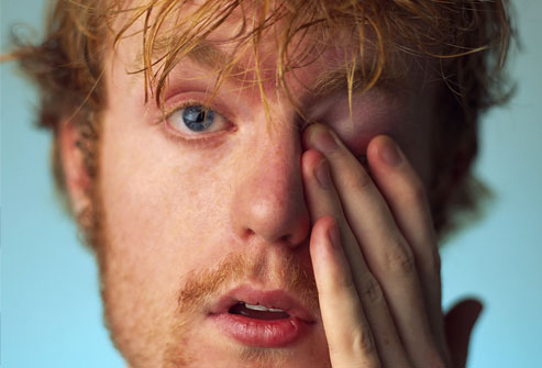 Конъюктивит: Причины, симптомы и лечение