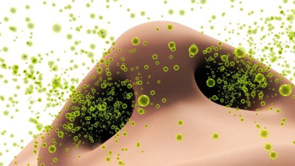 Хронический ринит