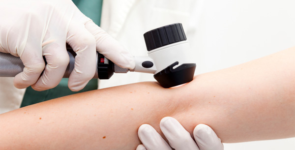 Многоформная эритема