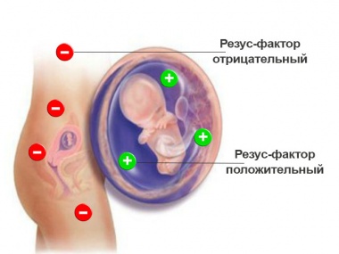 Реферат: Гемолитическая болезнь новорожденных