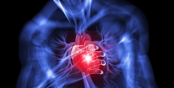 Дилатационная кардиомиопатия