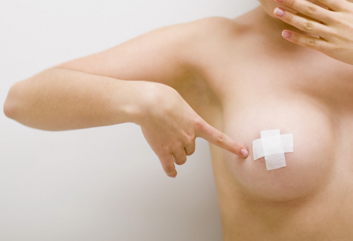 Воспаление молочной железы (мастит)