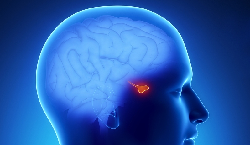 Гипопитуитаризм