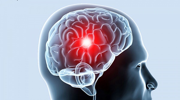 Ишемические атаки