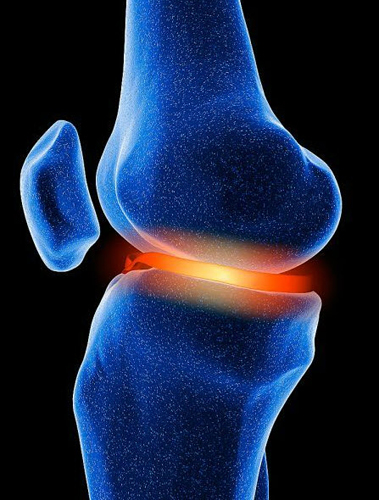 Боль в колене