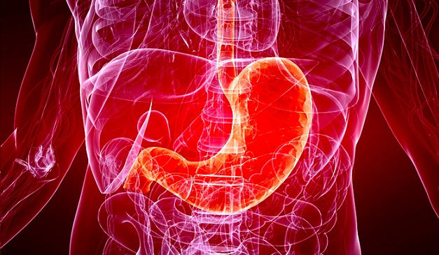 Острый гастрит