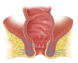 Трещина анального отверстия