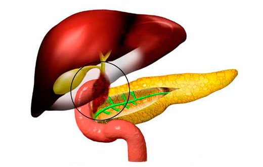 Дискинезия желчевыводящих путей
