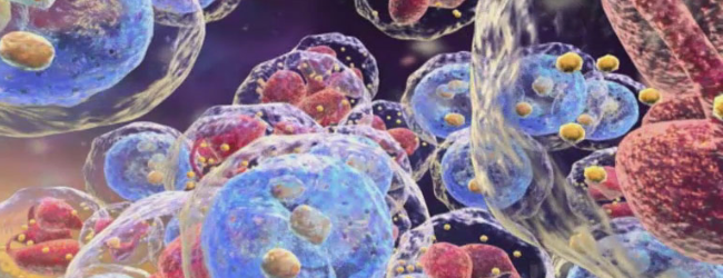 Хронический миелолейкоз