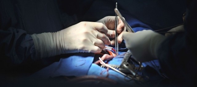 Гипертрофическая кардиомиопатия