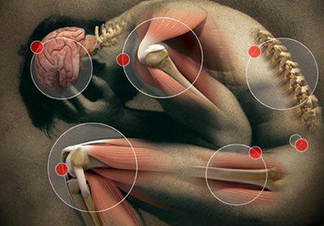 Системная красная волчанка