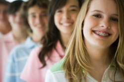 3 шага к ровным зубам и правильному прикусу. Брекеты и Ко