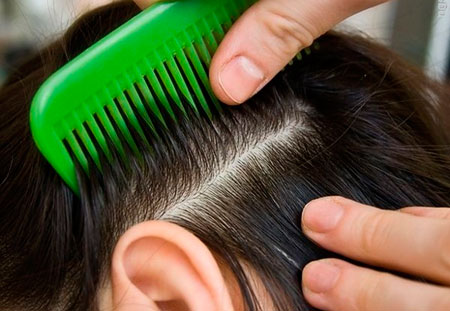 Болезнь Брилла