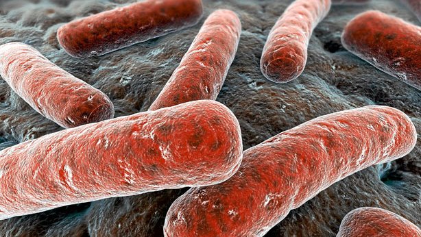 Милиарный туберкулез