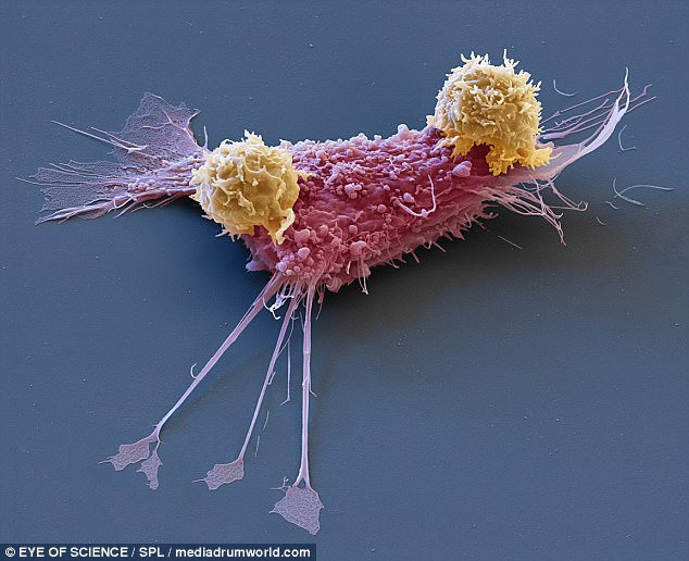 Как раковую опухоль атакуют CAR T-клетки: ФОТО увеличены в 2000 раз