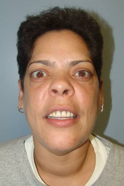 Нарушение гормонального баланса