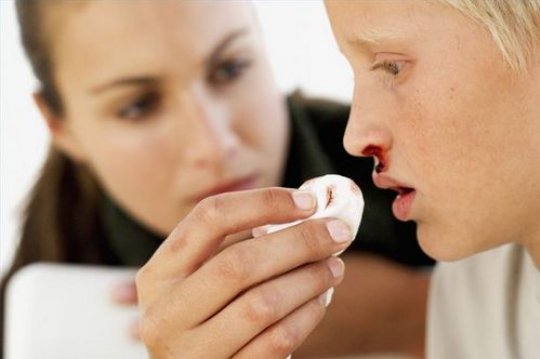 Кровь из носа у ребенка: где искать причины?