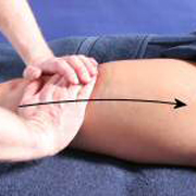 Разрыв/растяжение медиальной коллатеральной связки (внутренней боковой связки)