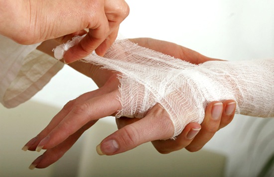 Споротрихоз