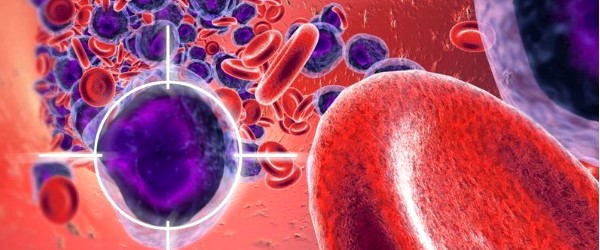 Миелоидный лейкоз острый