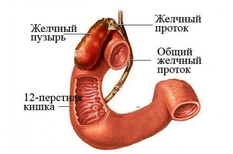 Водянка желчного пузыря