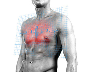 Ишемические атаки