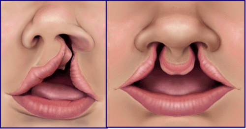 Расщелина неба