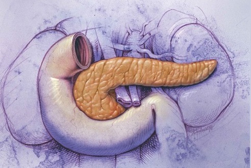 Острый панкреатит