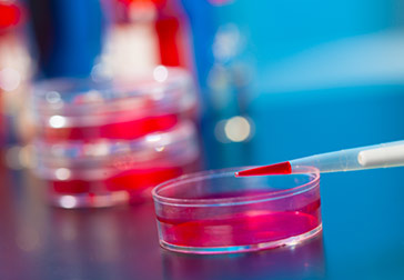 Миелоидный лейкоз острый