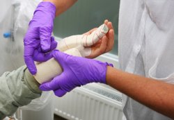 Гематома и ее лечение