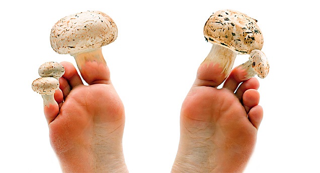 Дерматофития