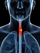 Дивертикул пищевода