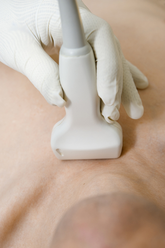 Нарушение гормонального баланса