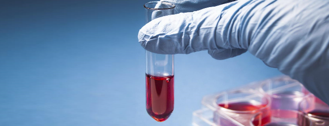 Острый вирусный гепатит