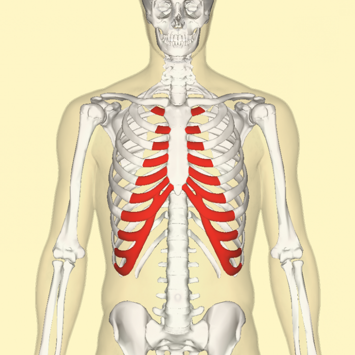 Синдром Титце