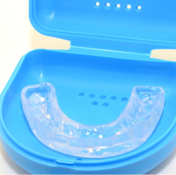 Бруксизм у подростка: причины, последствия и профилактические меры