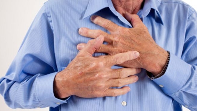 Мерцательная аритмия